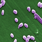 Anthrax Bacteria